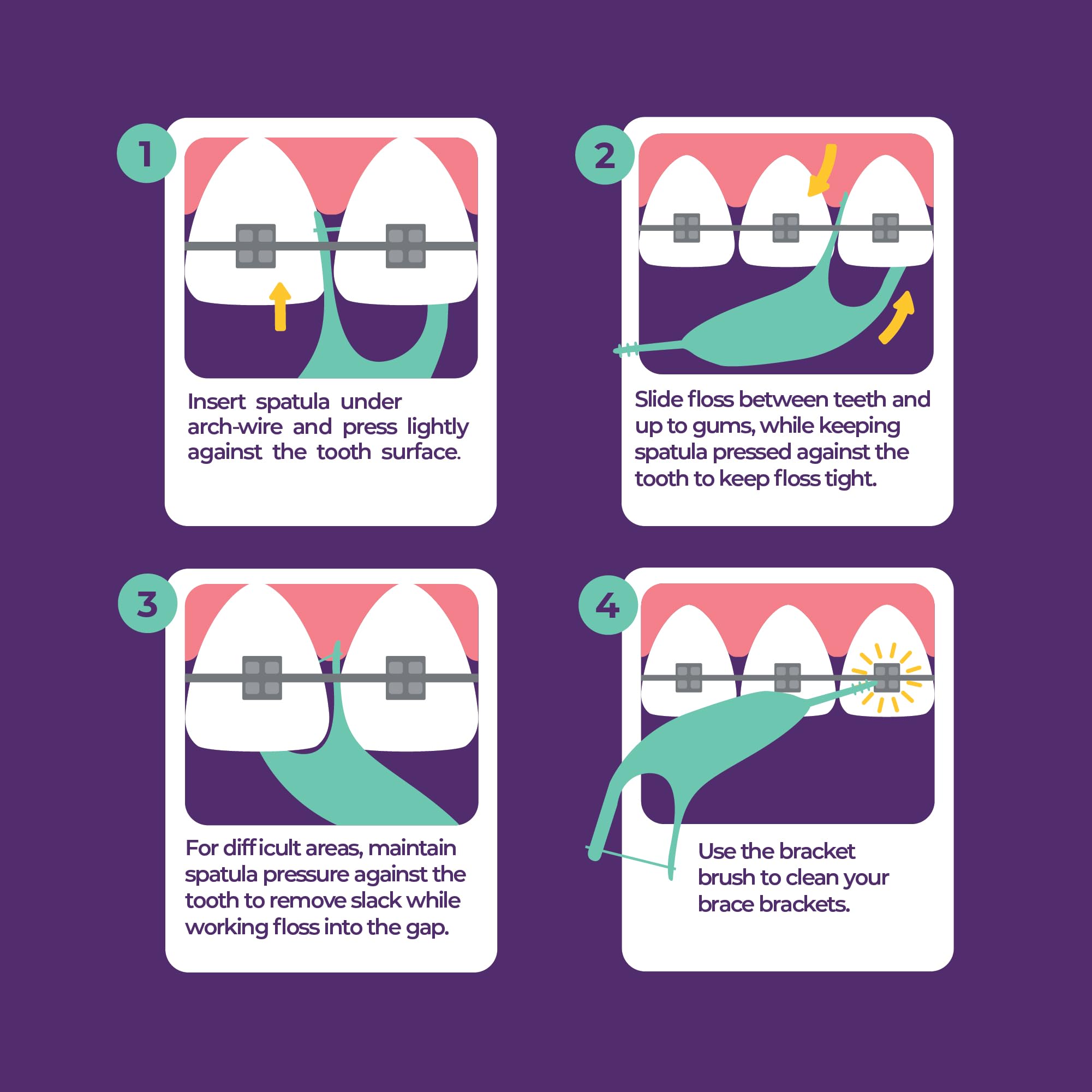 Made in the USA Platypus orthodontic flossers are safe and non-damaging