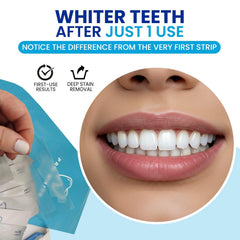 Close-up of whitening strips adhering to teeth during use