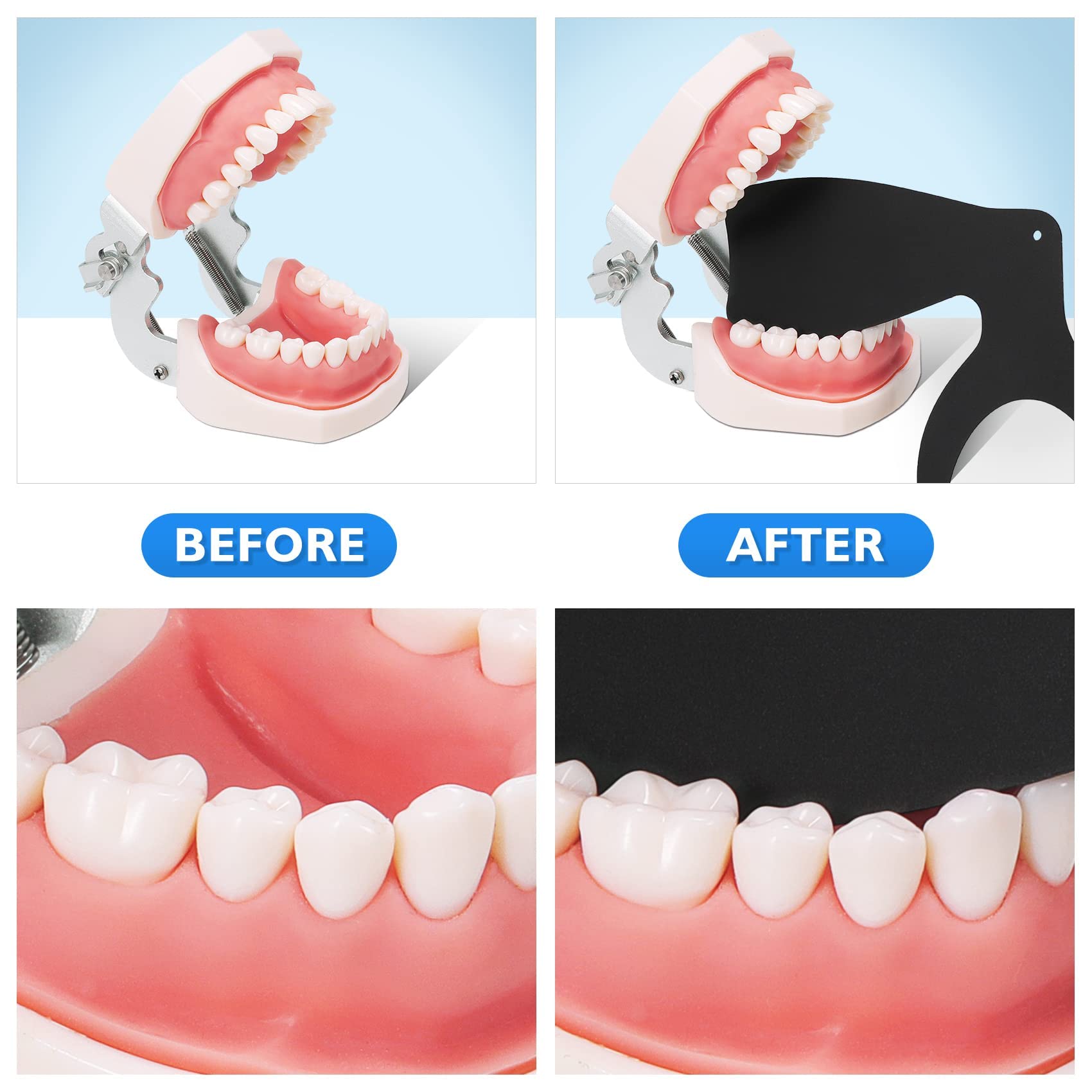 All six models of the Protector 6 Pcs Dental Contraster arranged for display