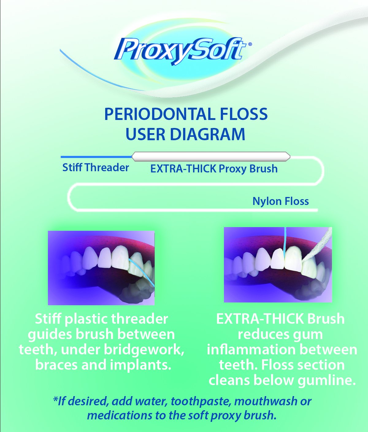 Threader tip guiding floss between teeth and braces