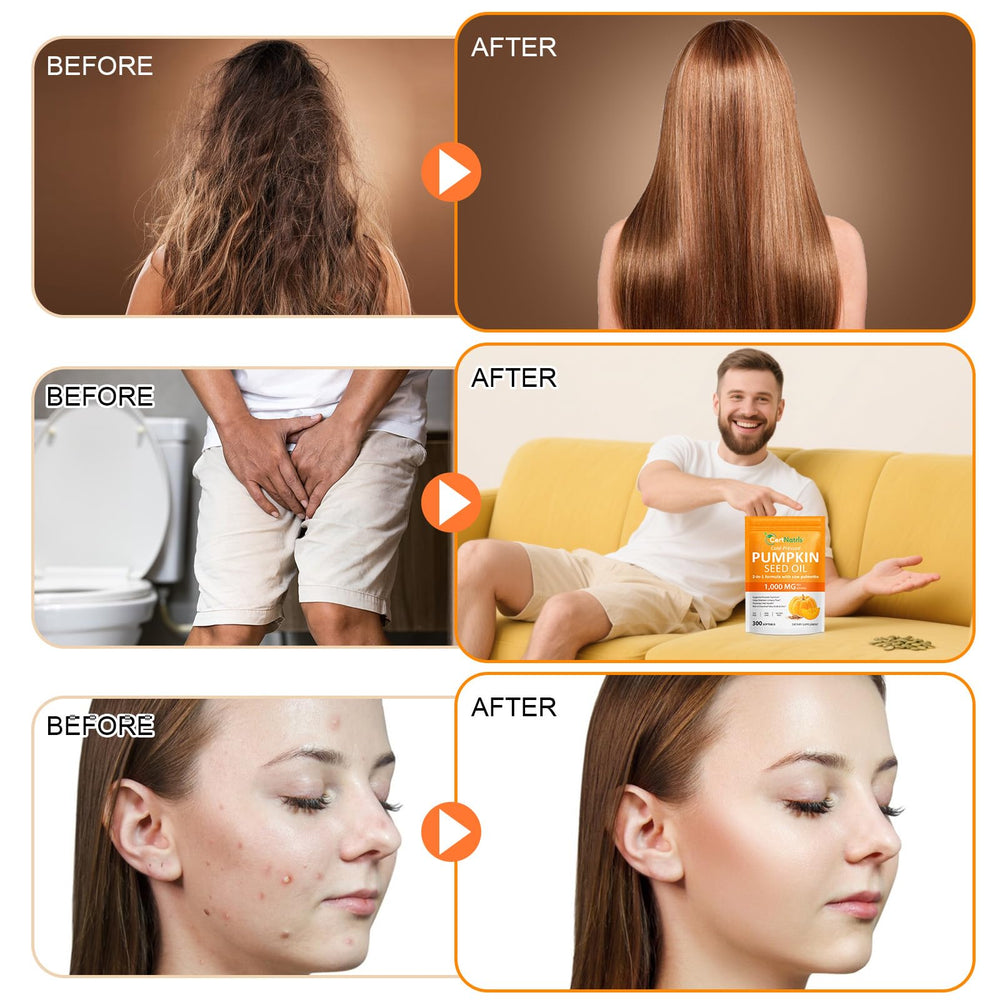 Concept image depicting hair growth and prostate health