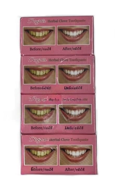 Rasyan Herbel Clove Toothpaste four-box package