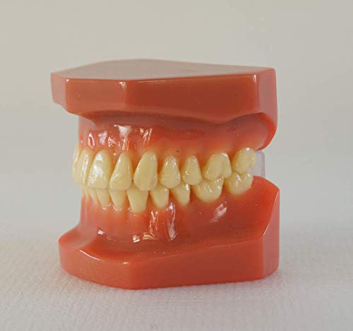 Detail of teeth in red typodont - non-removable
