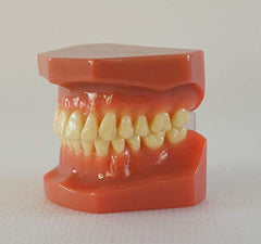Detail of teeth in red typodont - non-removable