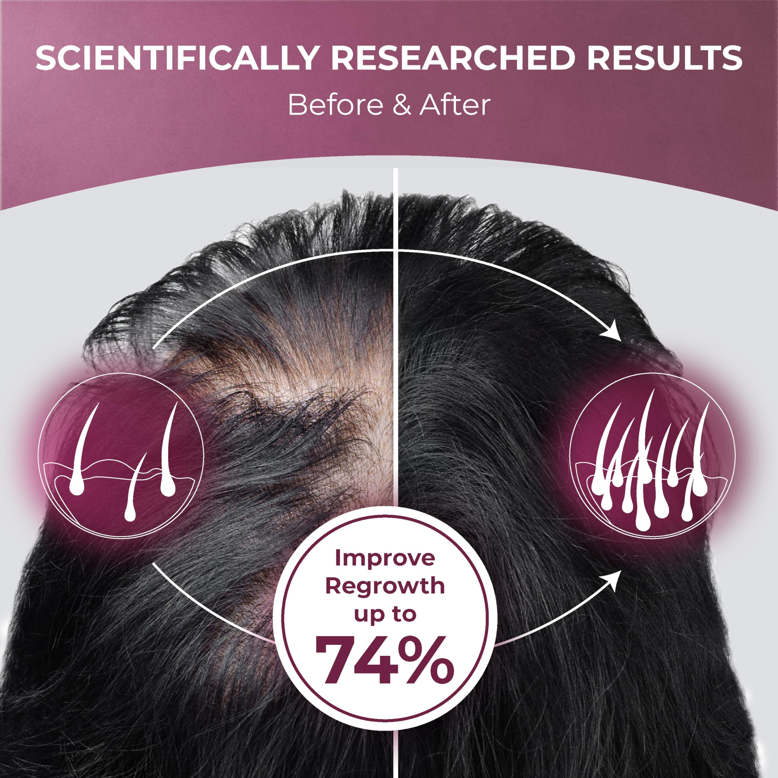 Keratin, L-lysine, Biotin and Vitamin D for hair health