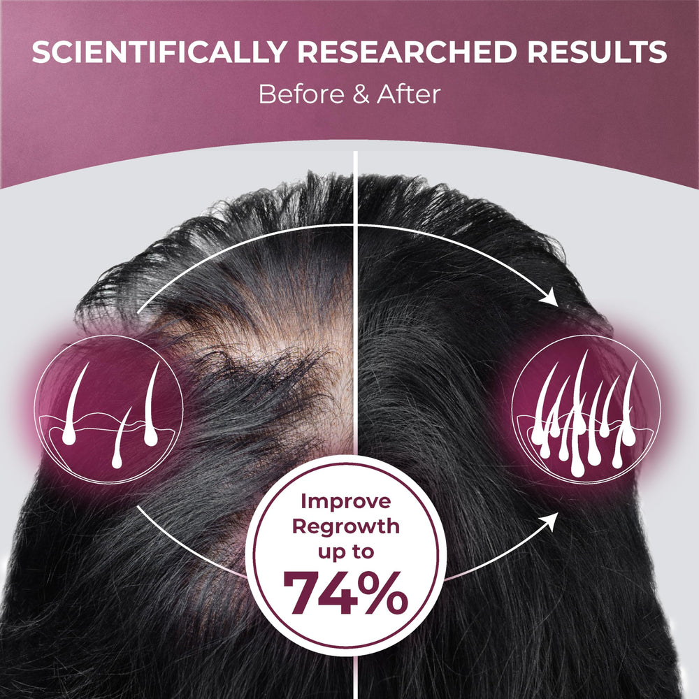 Keratin, L-lysine, Biotin and Vitamin D for hair health