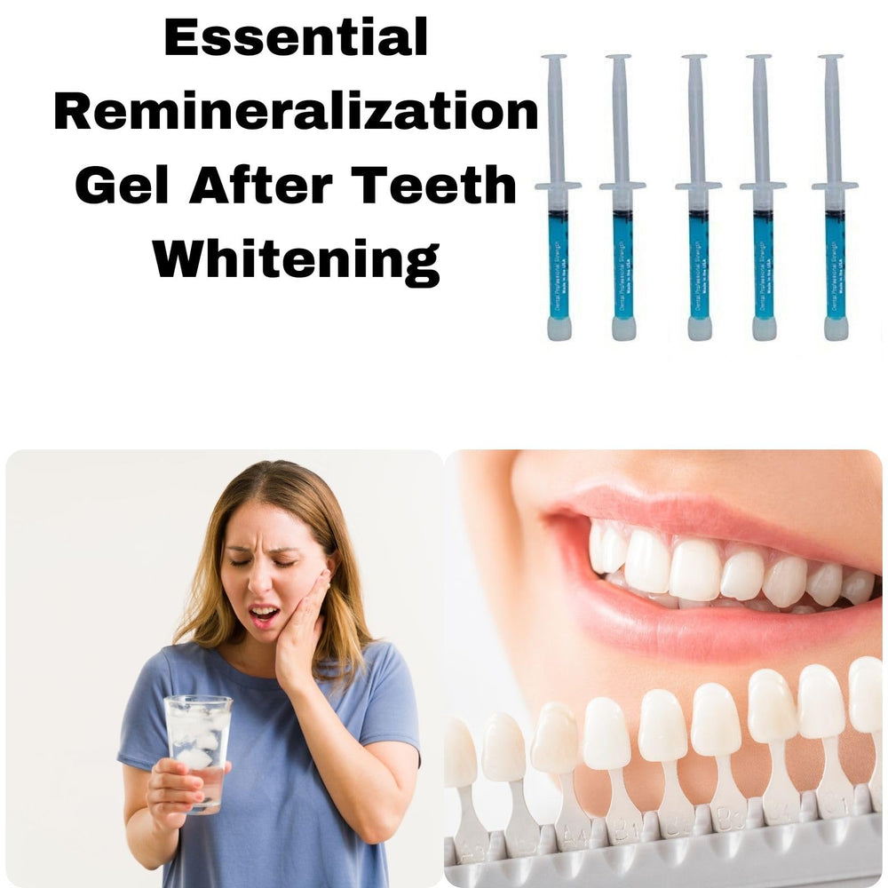 Remineralization Gel after teeth whitening