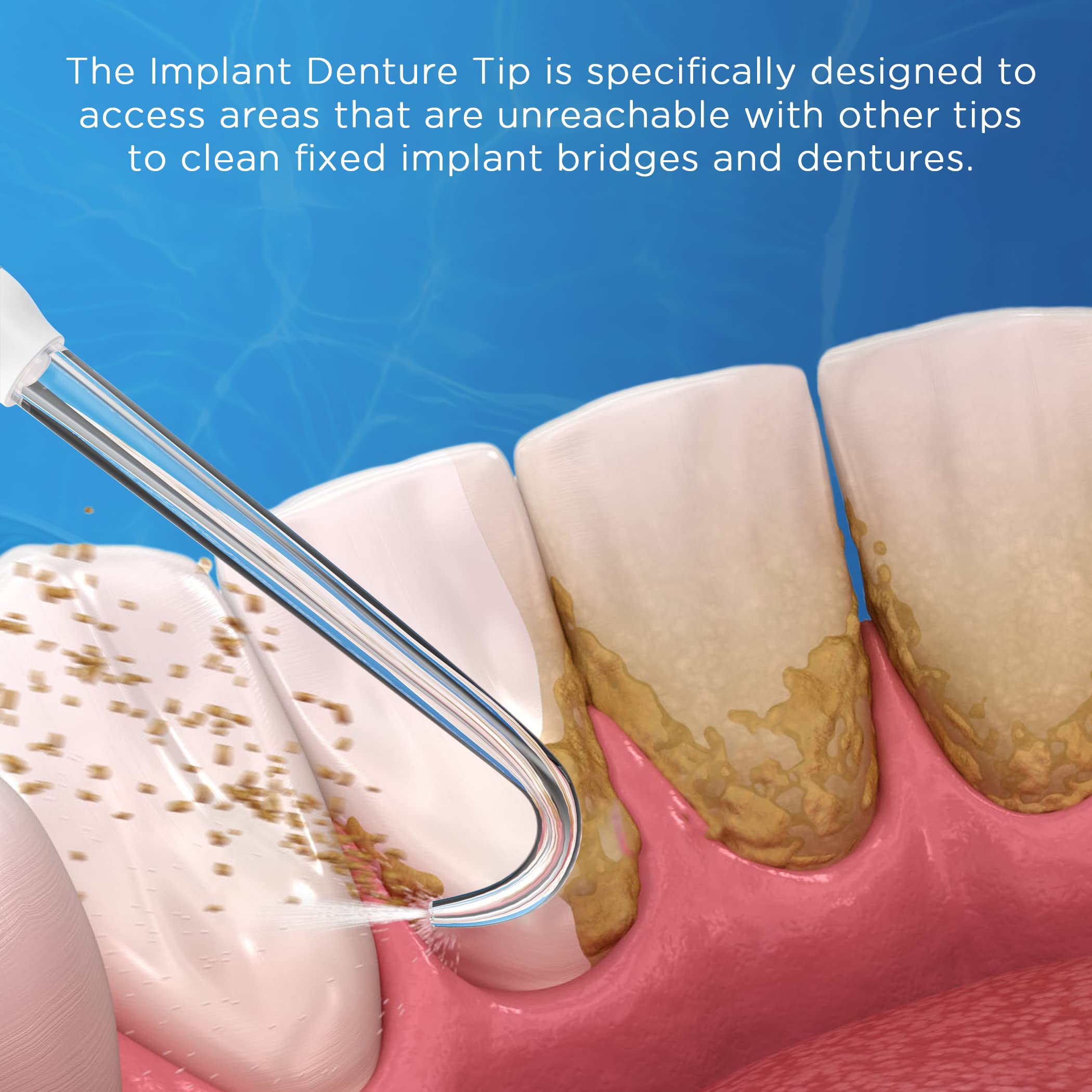 Color-coded denture tips for family members