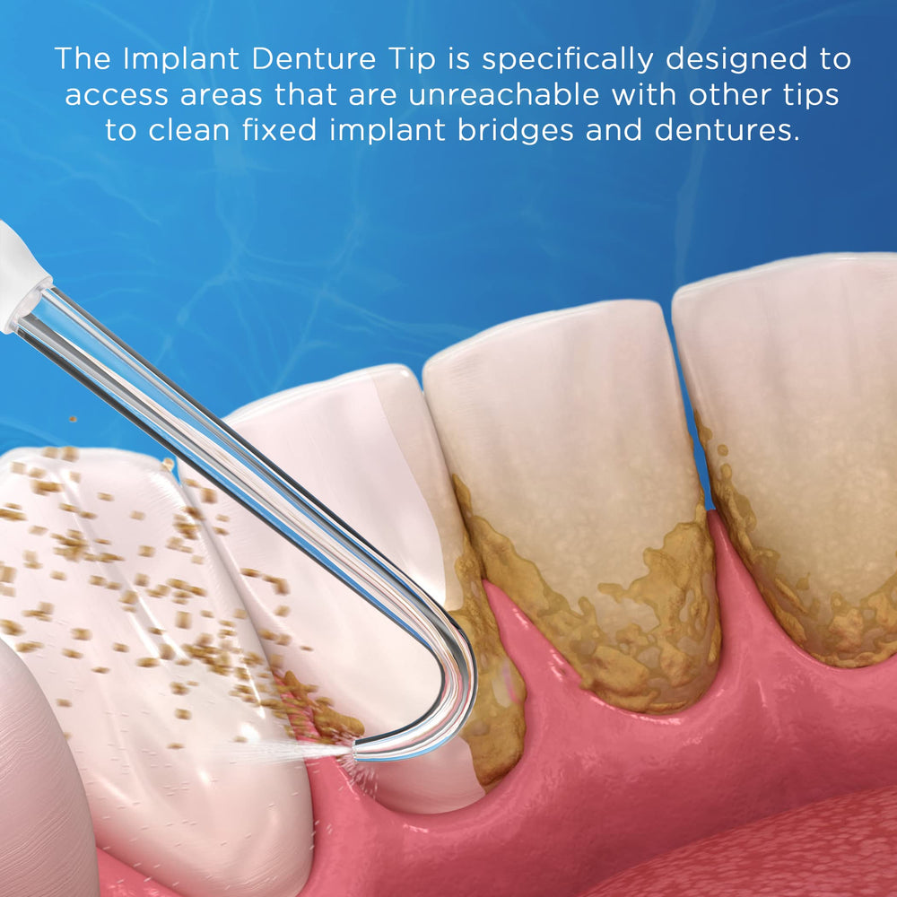 Color-coded denture tips for family members