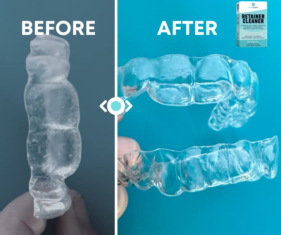 Packaging and product shot of Fresh Knight Retainer Cleaner Tablets