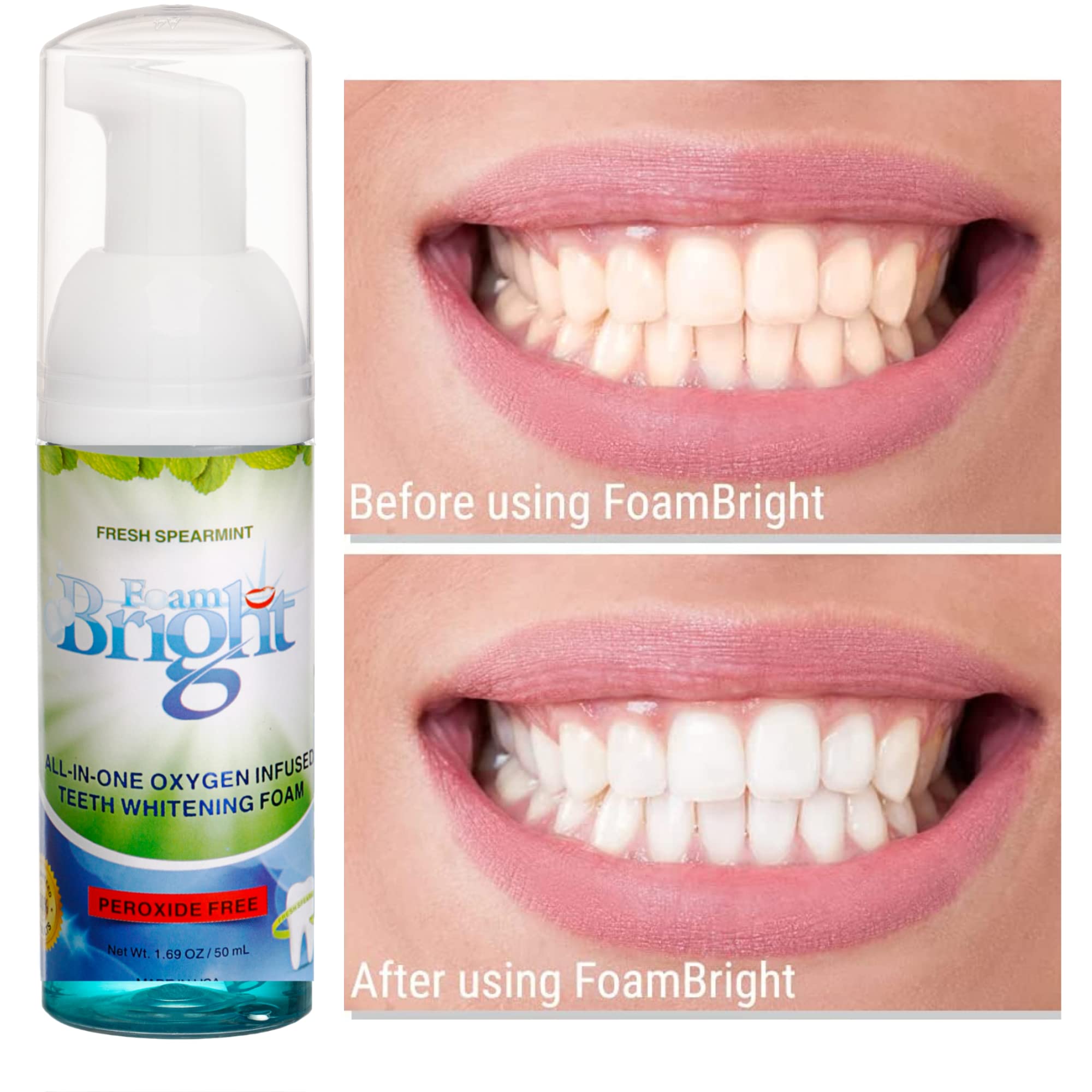 Bright smile after using FoamBright Retainer Foam Cleaner