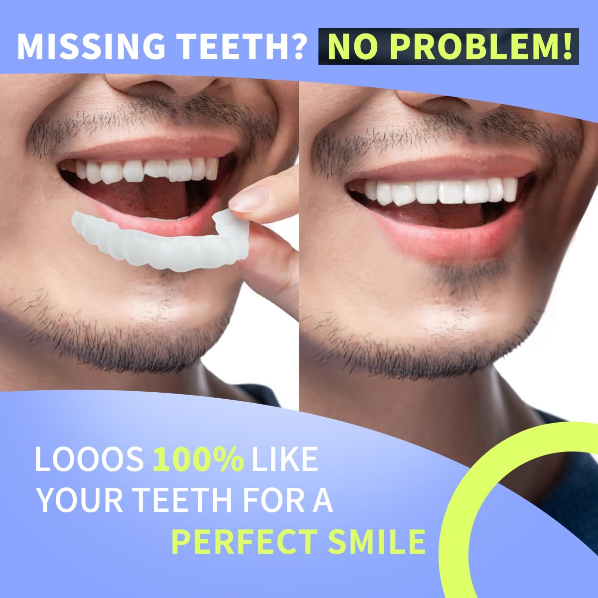 Packaging of white dental retainers