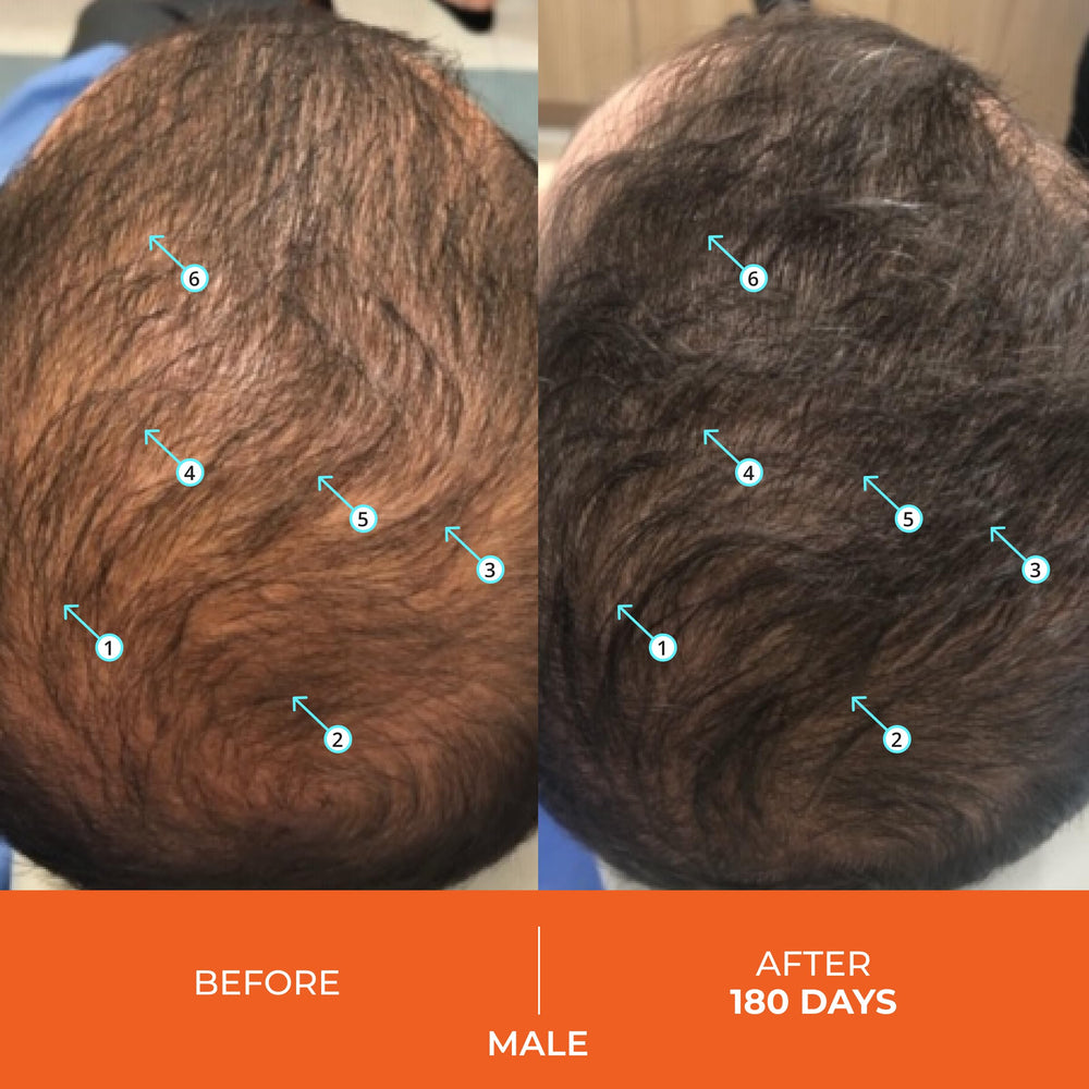 Daily use illustration of Revita Hair Vitamin Gummies