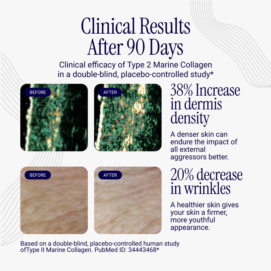 Graphic highlighting joint health and mobility benefits