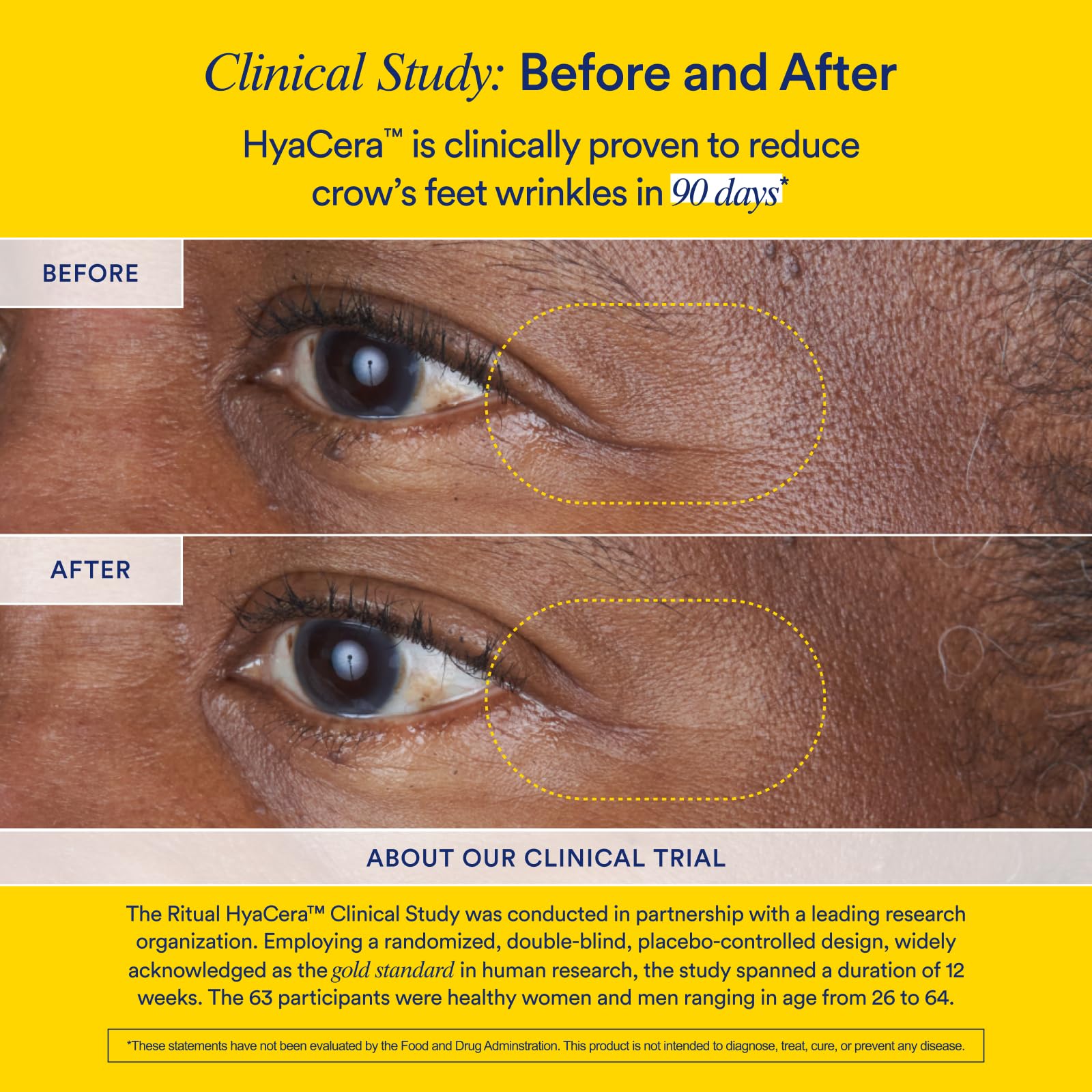 Clinical trial results graphic showing wrinkle reduction
