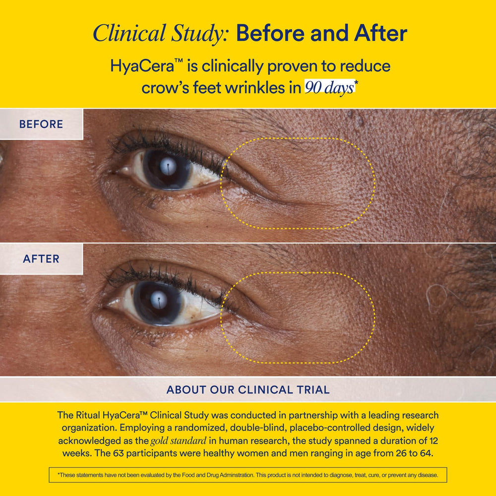 Clinical trial results graphic showing wrinkle reduction