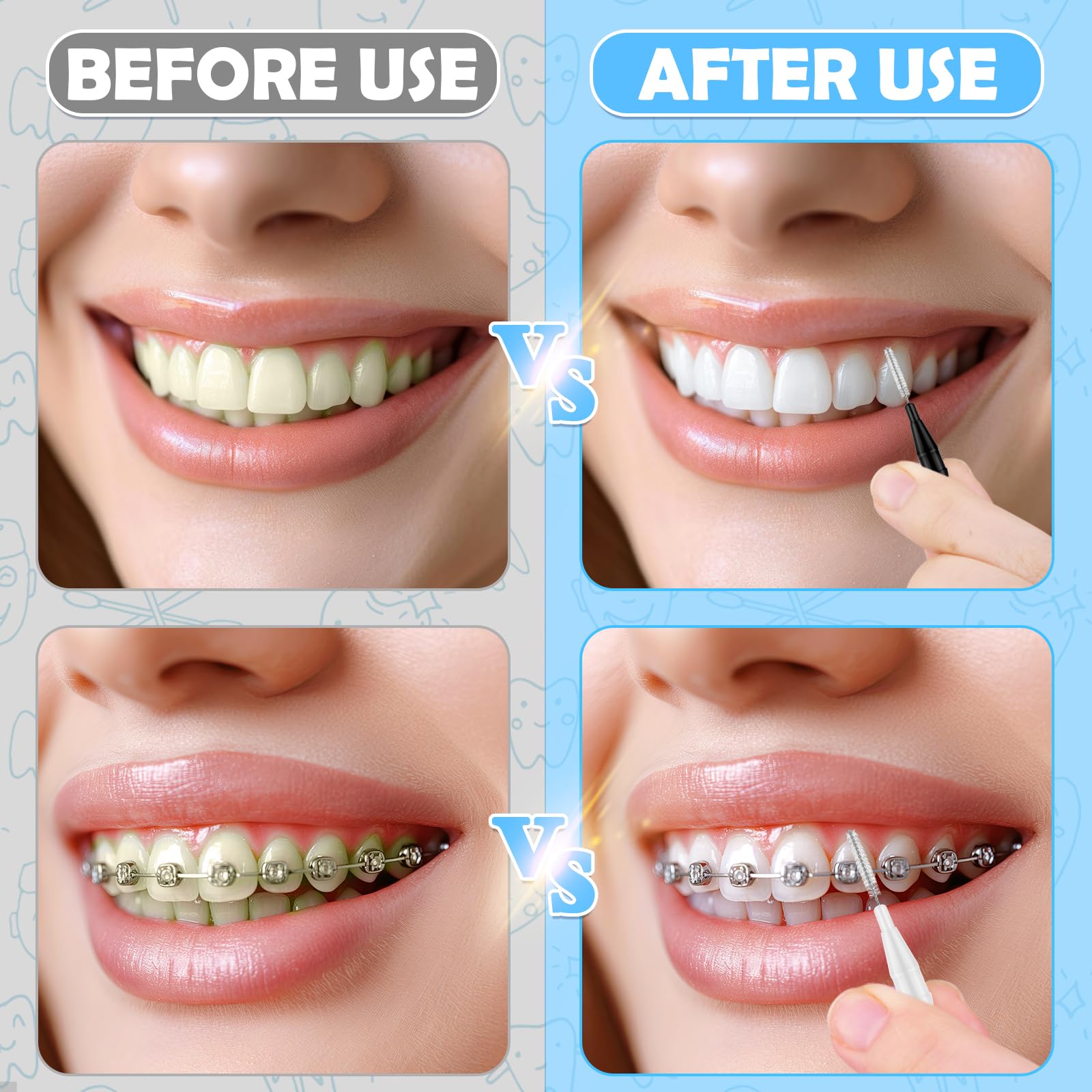 Close-up of 360° bendable interdental brush head for braces