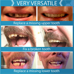 Rows of customizable teeth to choose from