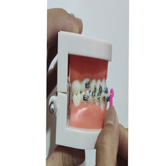 Premium non-toxic material of dental elastic placers