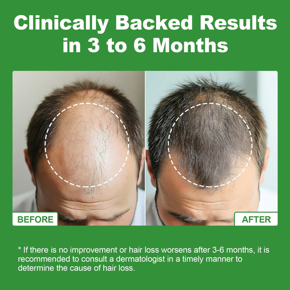 Hair growth support benefits and DHT blocking