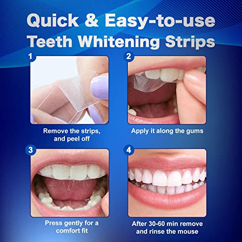 Whitening strips applied to upper teeth during use