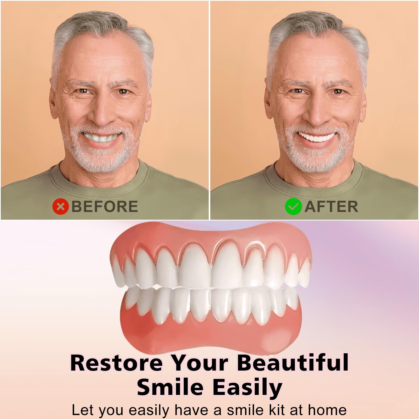 Close-up of silicone denture veneers color matching