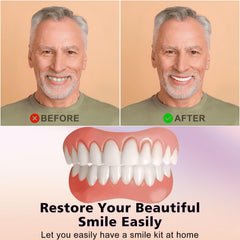 Close-up of silicone denture veneers color matching