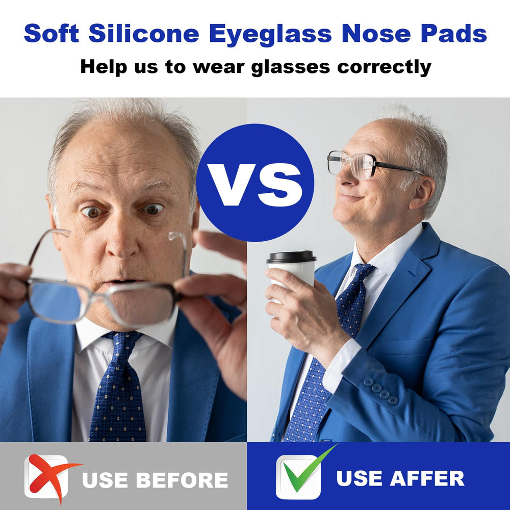 SMARTTOP nose pads product box and contents