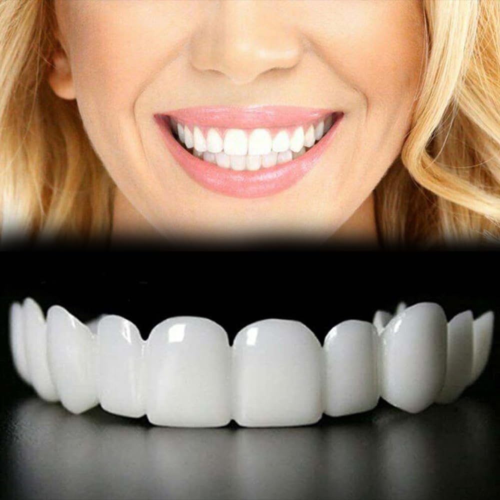 Adjustable top and bottom smile aligners worn by a man and a woman