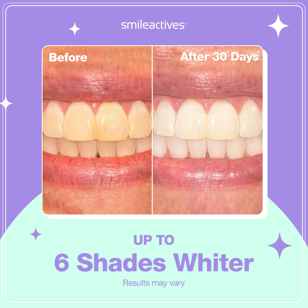 Whitening gel applied to teeth with precision brush