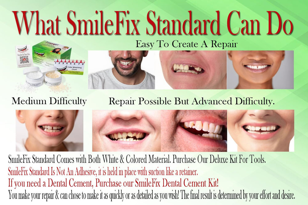 Color matching beads for SmileFix