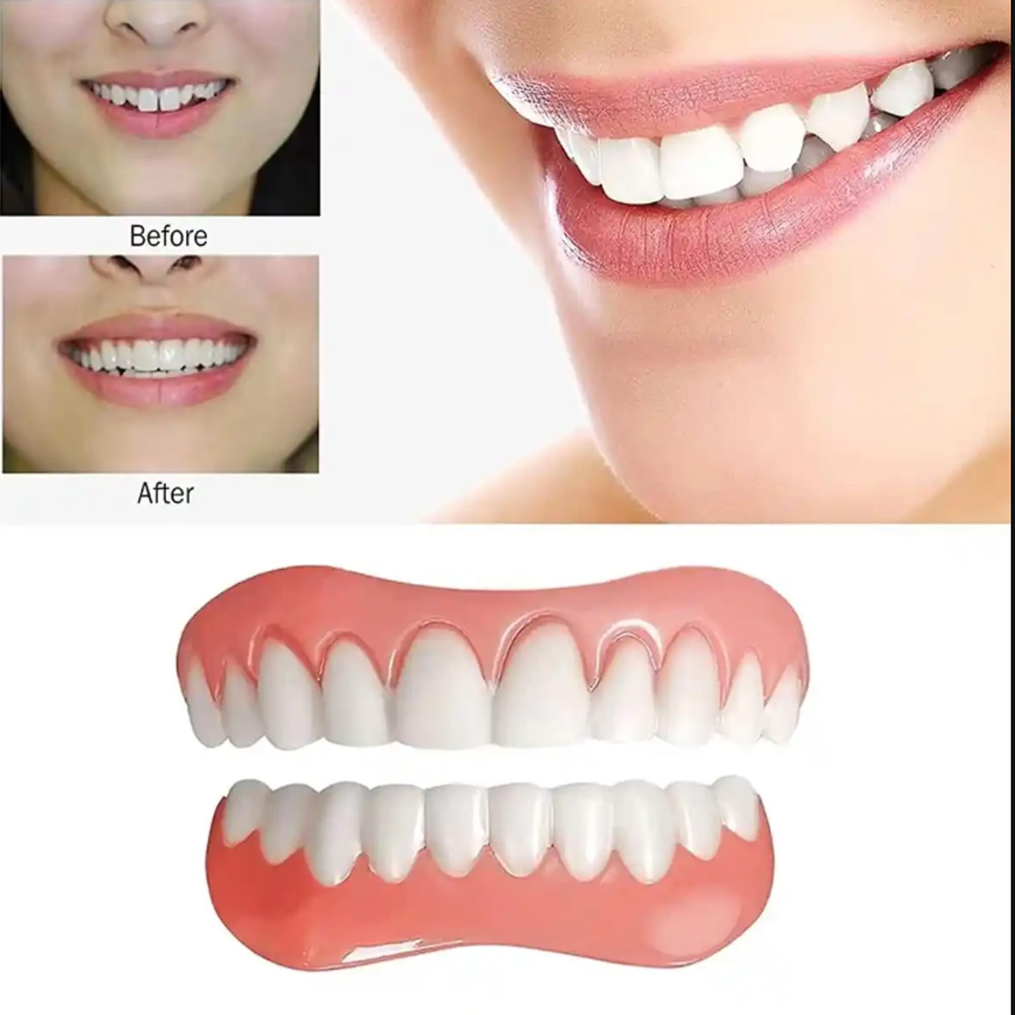 Applying Smileheven veneers to teeth for secure, comfortable fit