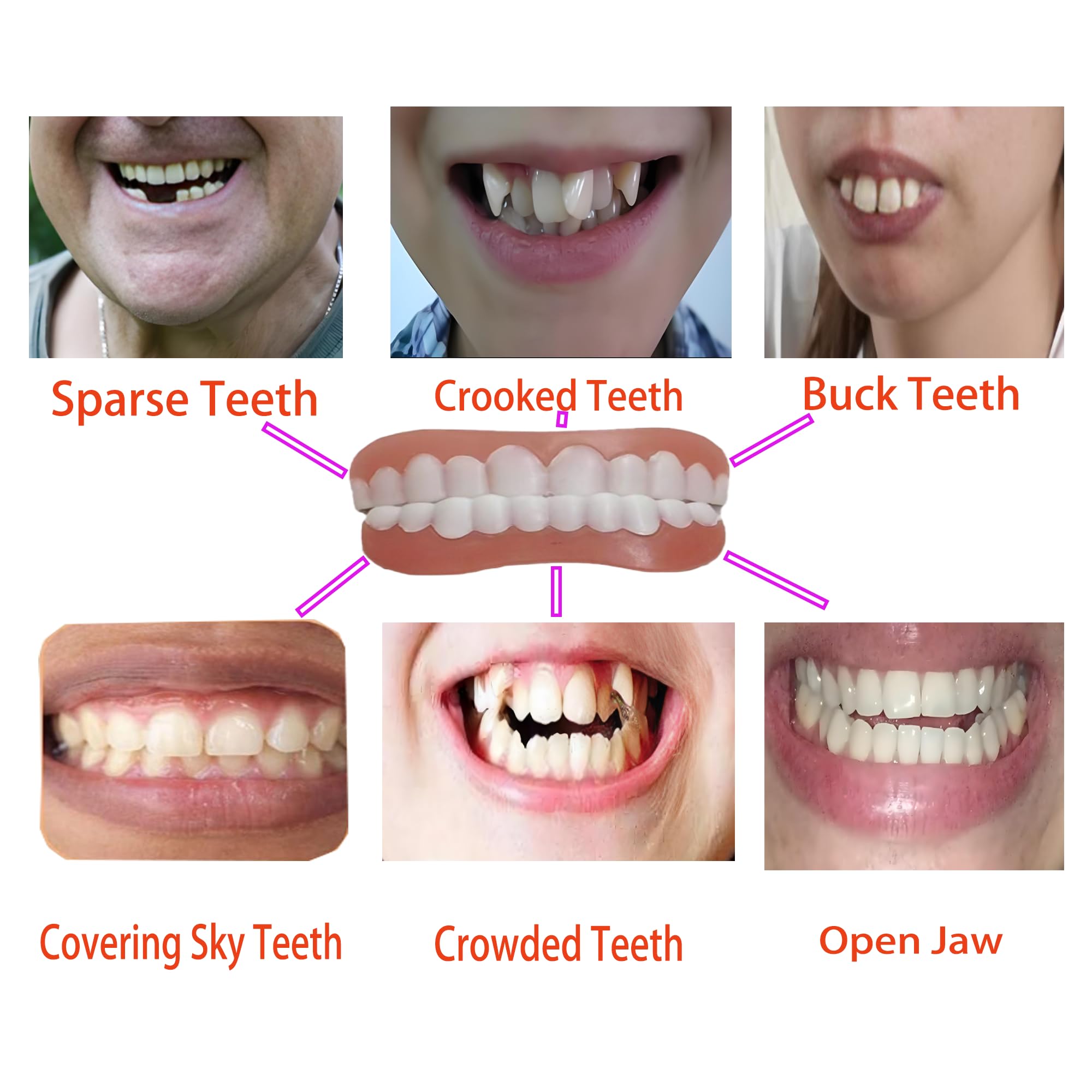 Precision tweezers included in Smileheven kit