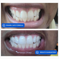 Peeling whitening strip from backing