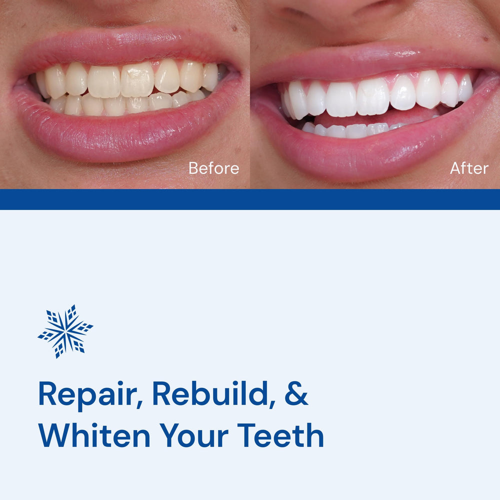 Diamond LED mouthpiece for Snow Teeth Whitening Kit