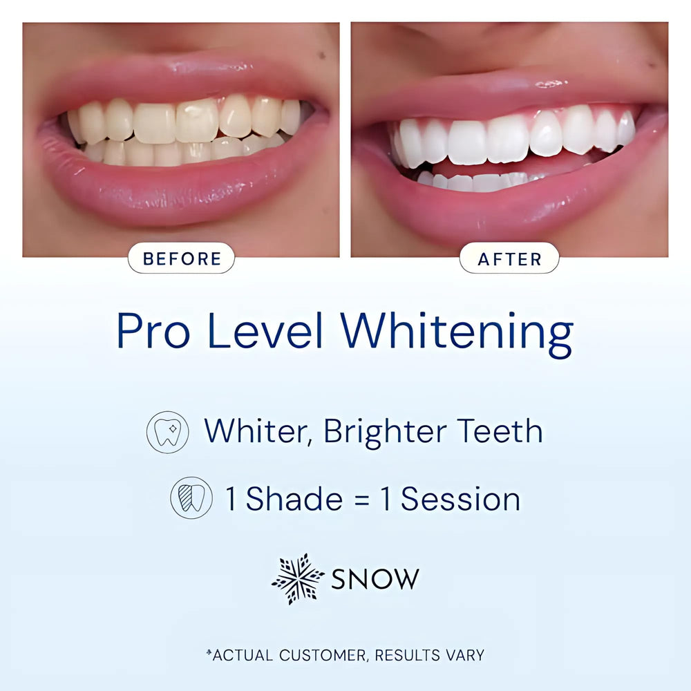 SNOW teeth shade guide