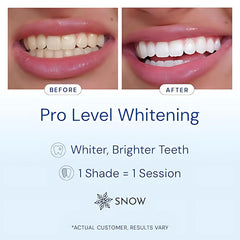 SNOW teeth shade guide