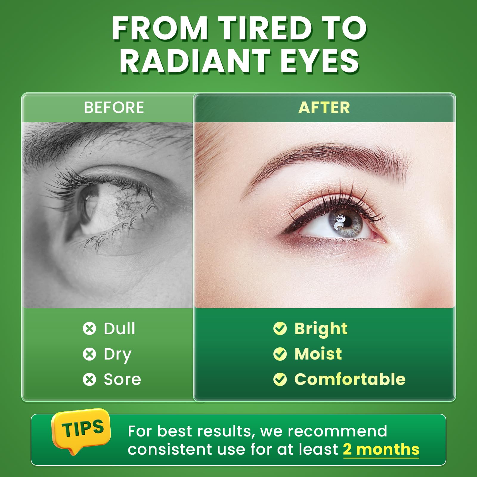 Sodium hyaluronate for ocular comfort