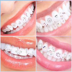 DIY tooth gem kit contents with gems and tools