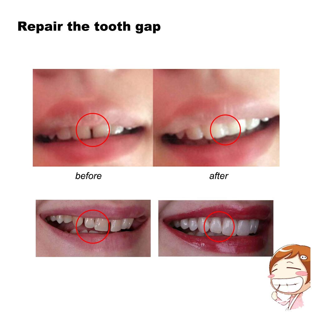 Beads used to repair a tooth model