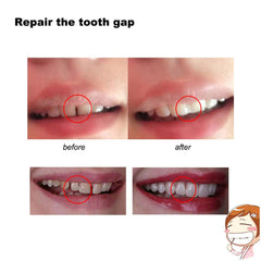 Beads used to repair a tooth model