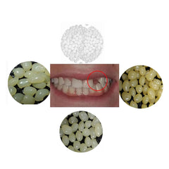 Front view of Sowsmile 4-color temporary dental repair beads kit