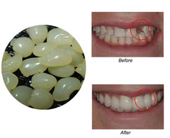 Sowsmile beads color 3 for temporary teeth repair
