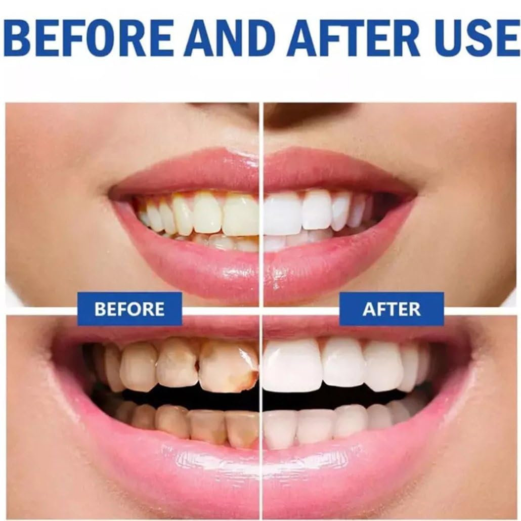 Smiling teeth after using SP10 Probiotic Toothpaste