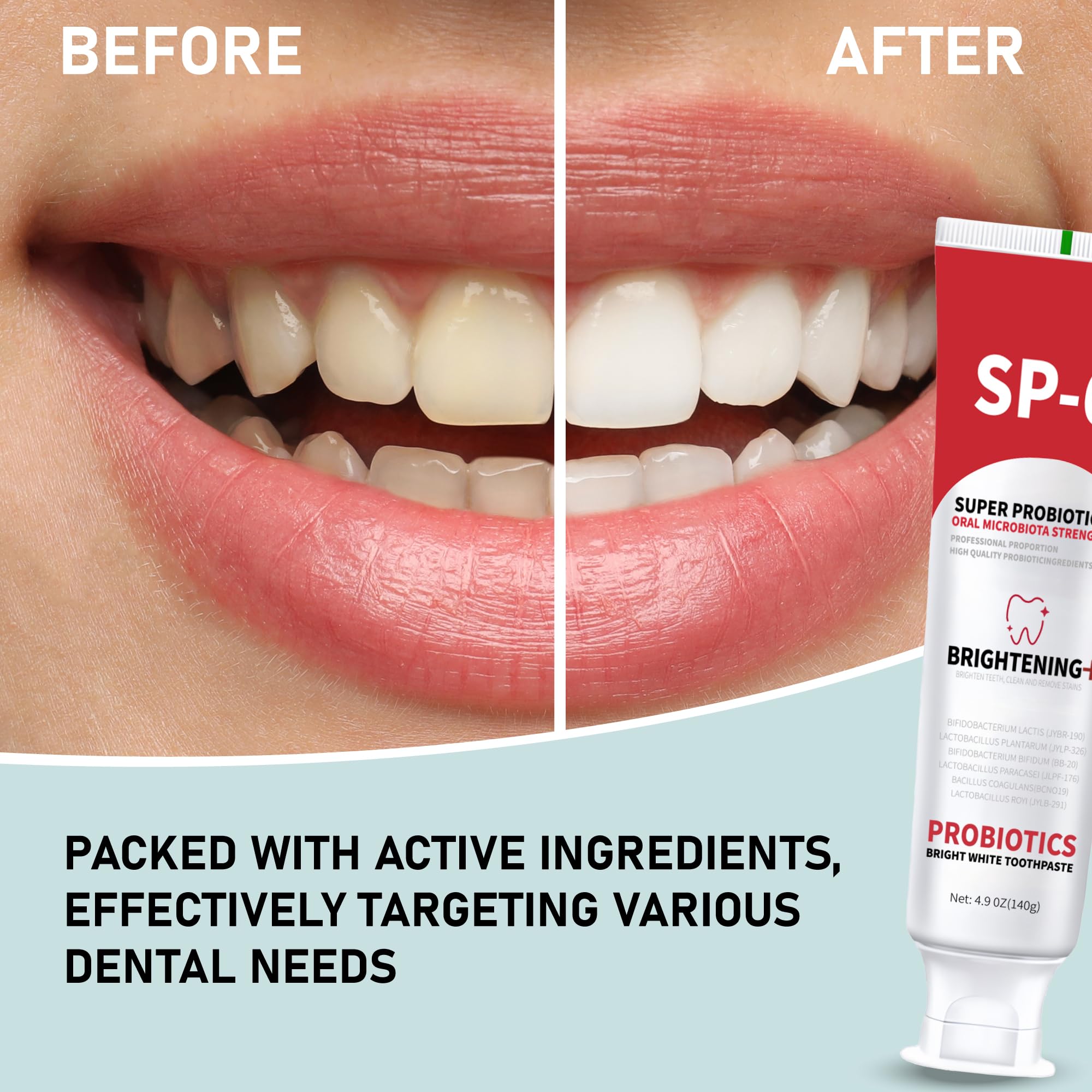 Daily-use toothpaste demonstrating gentle cleaning