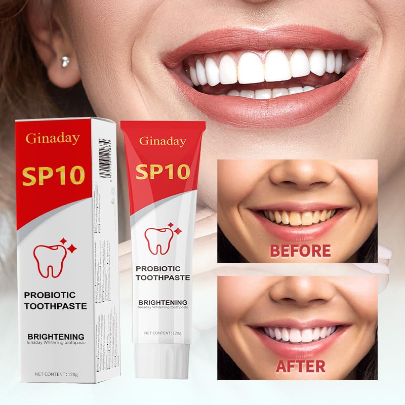 Close-up of SP10 toothpaste tube showing probiotic whitening formula