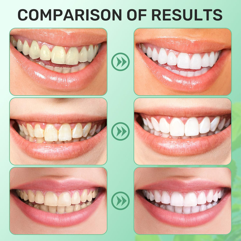 Whitening teeth and fresh breath benefits