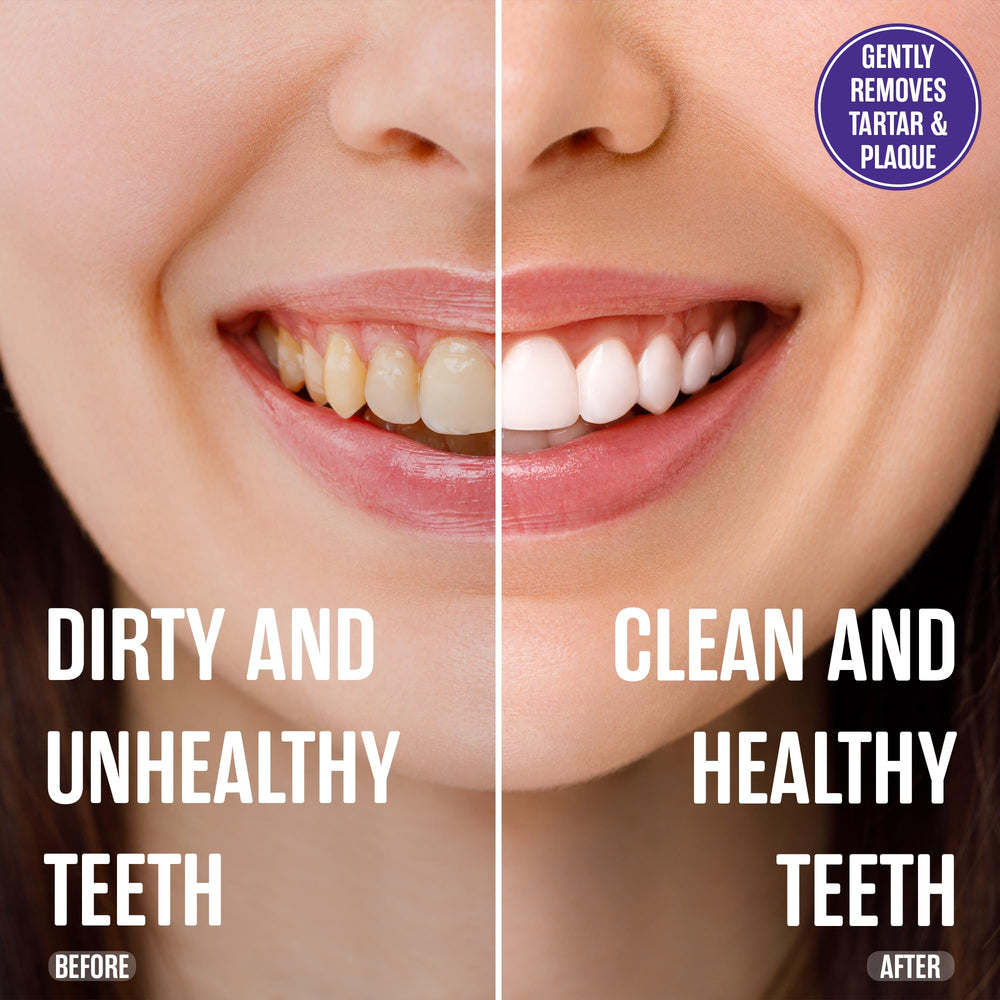 SLS-free and paraben-free toothpaste formula