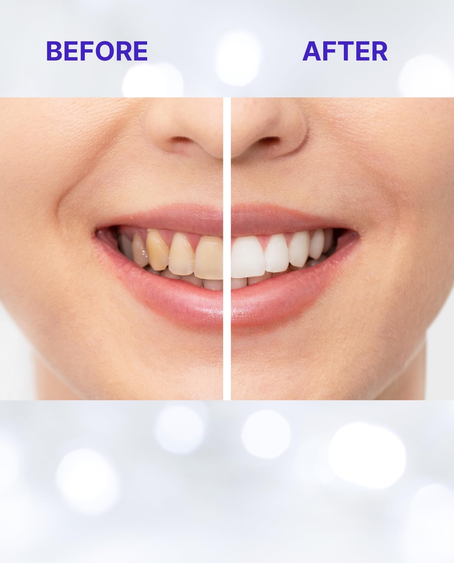 Flexible no-slip whitening strips applied to teeth