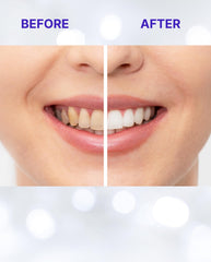 Flexible no-slip whitening strips applied to teeth